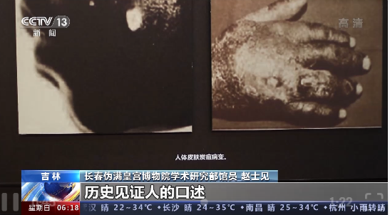 正文图片