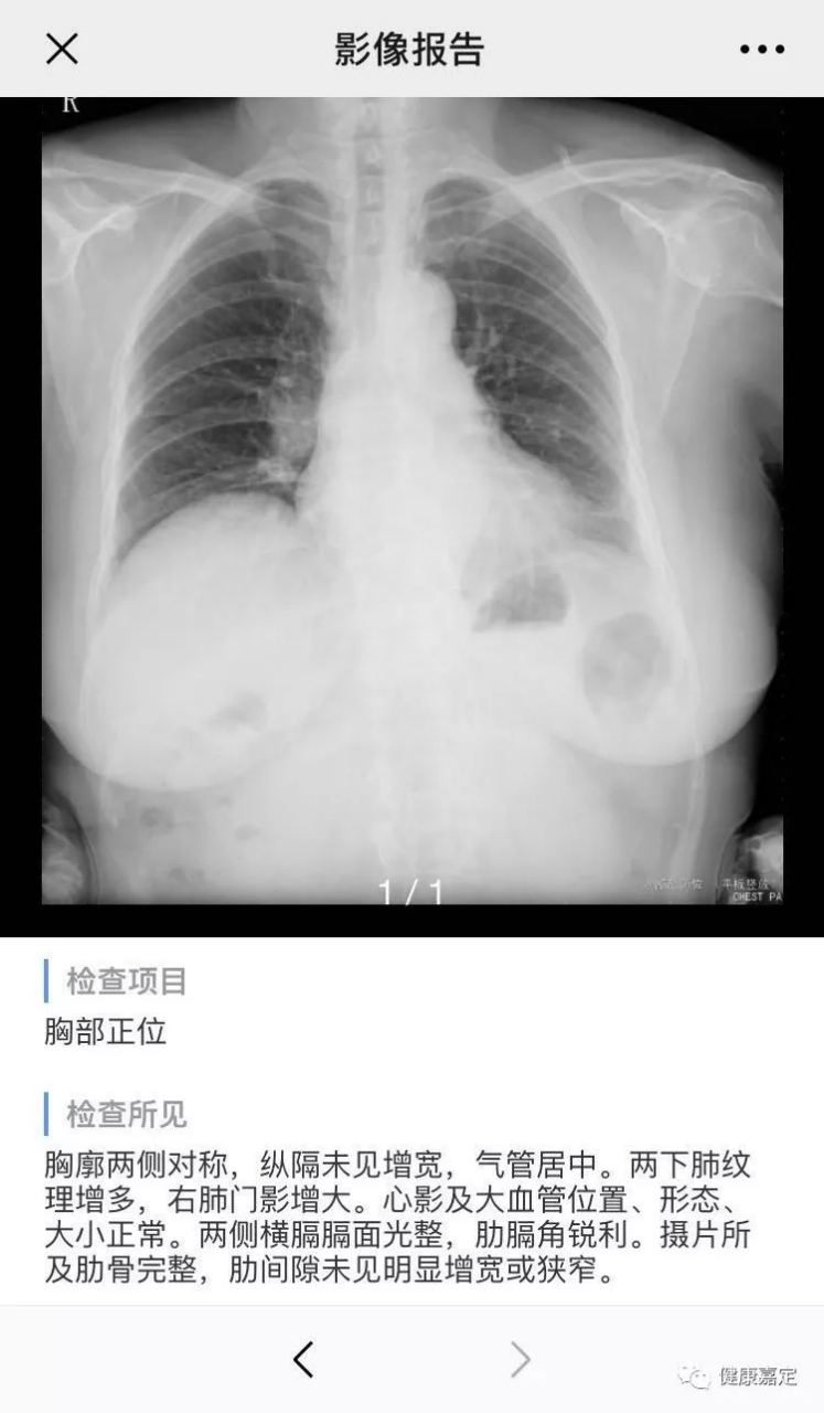 afdc8088696d4b0f899310ae7531c95e.png